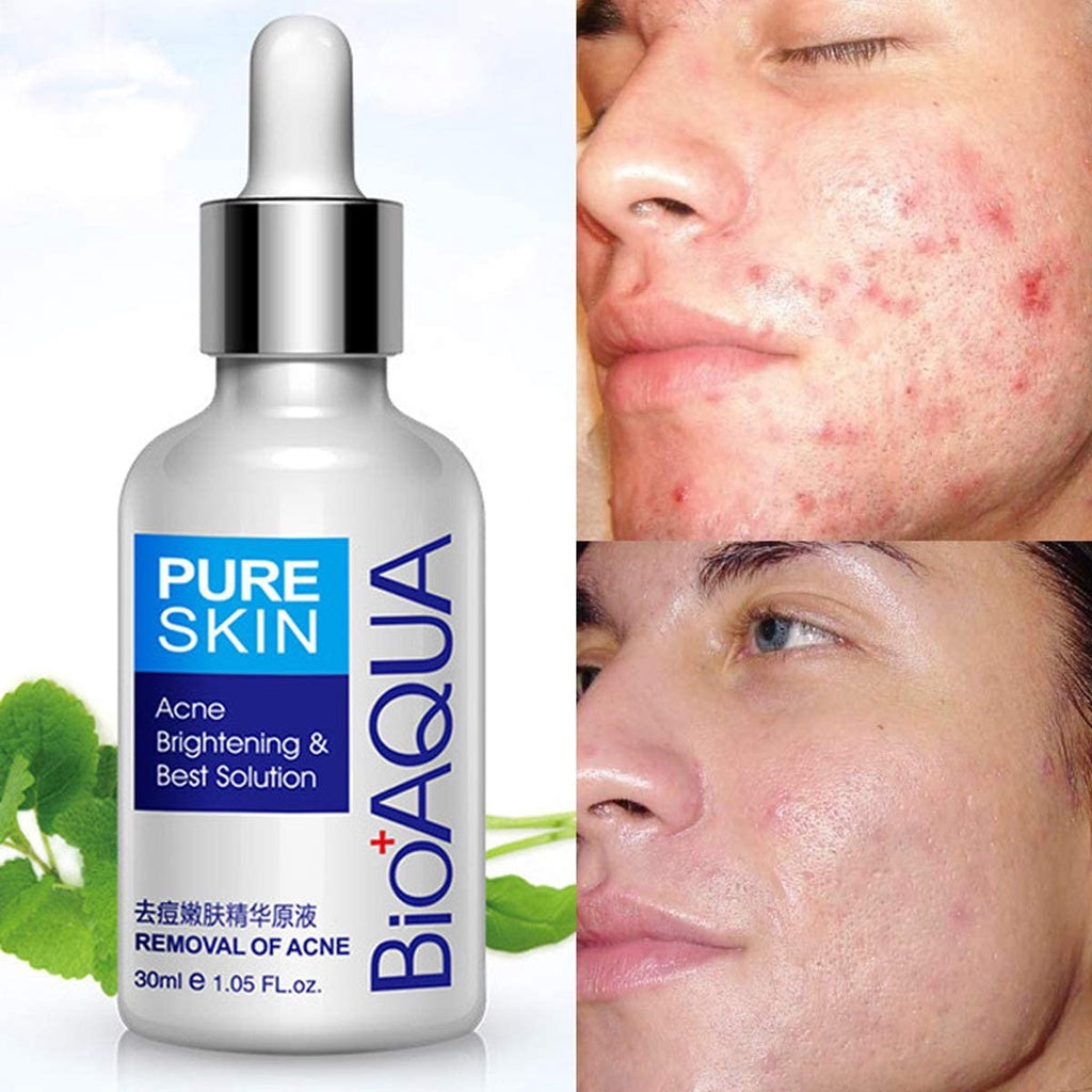 TONICO ANTI-ACNE  BIOAQUA