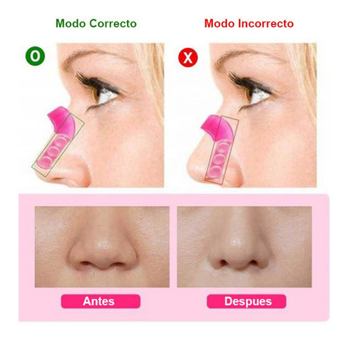 respingador de nariz levantador corrector nasal perfilador