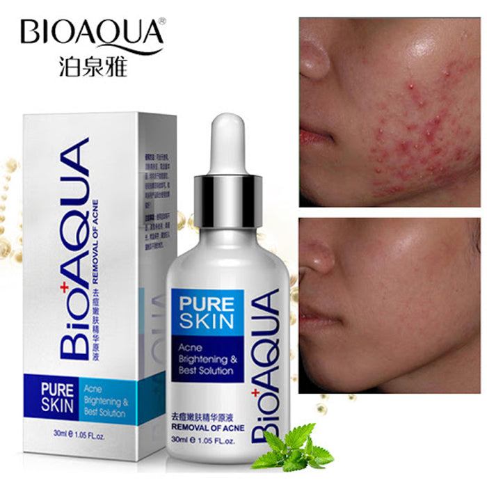 TONICO ANTI-ACNE  BIOAQUA